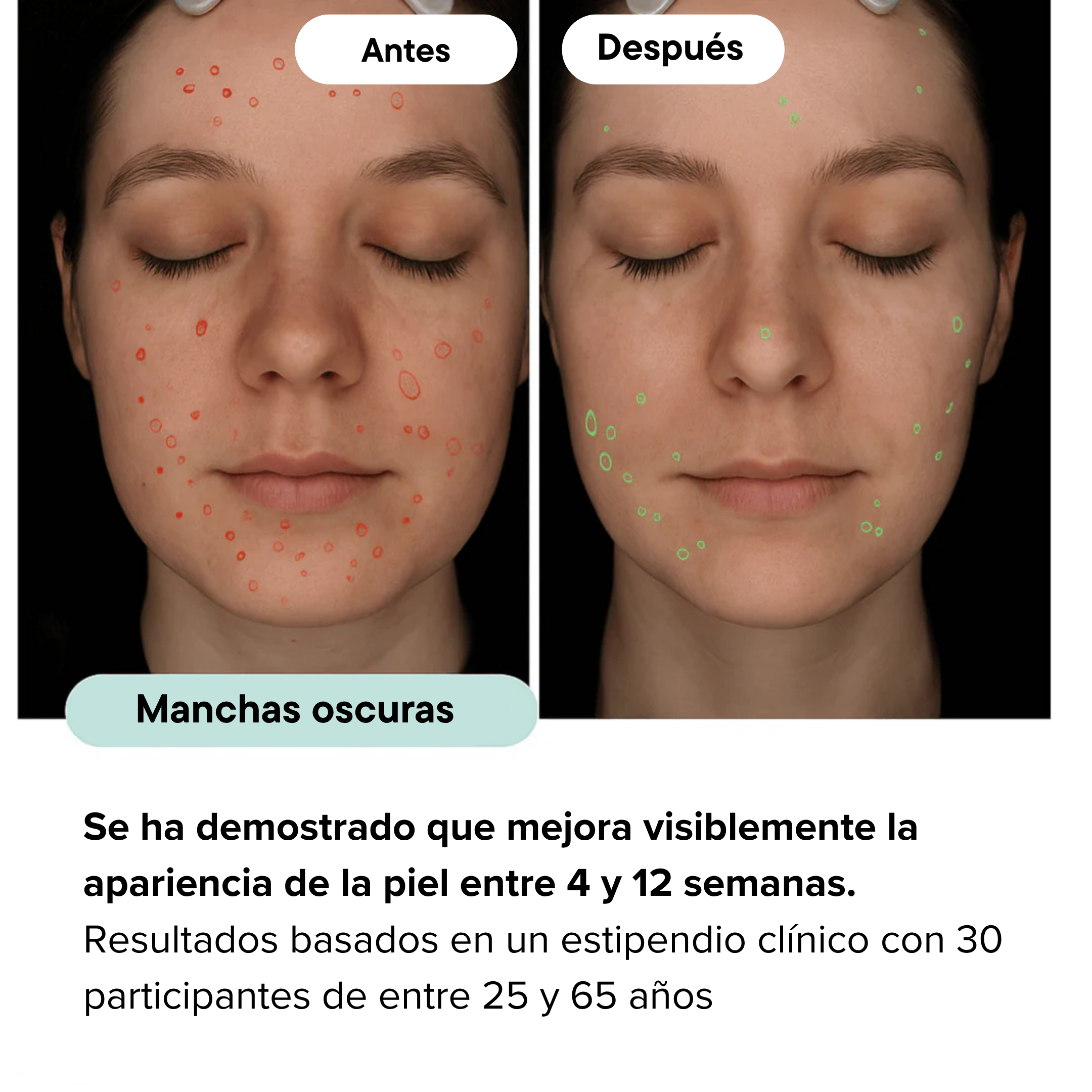 Sistema de Infusión Microneedling Anti-edad