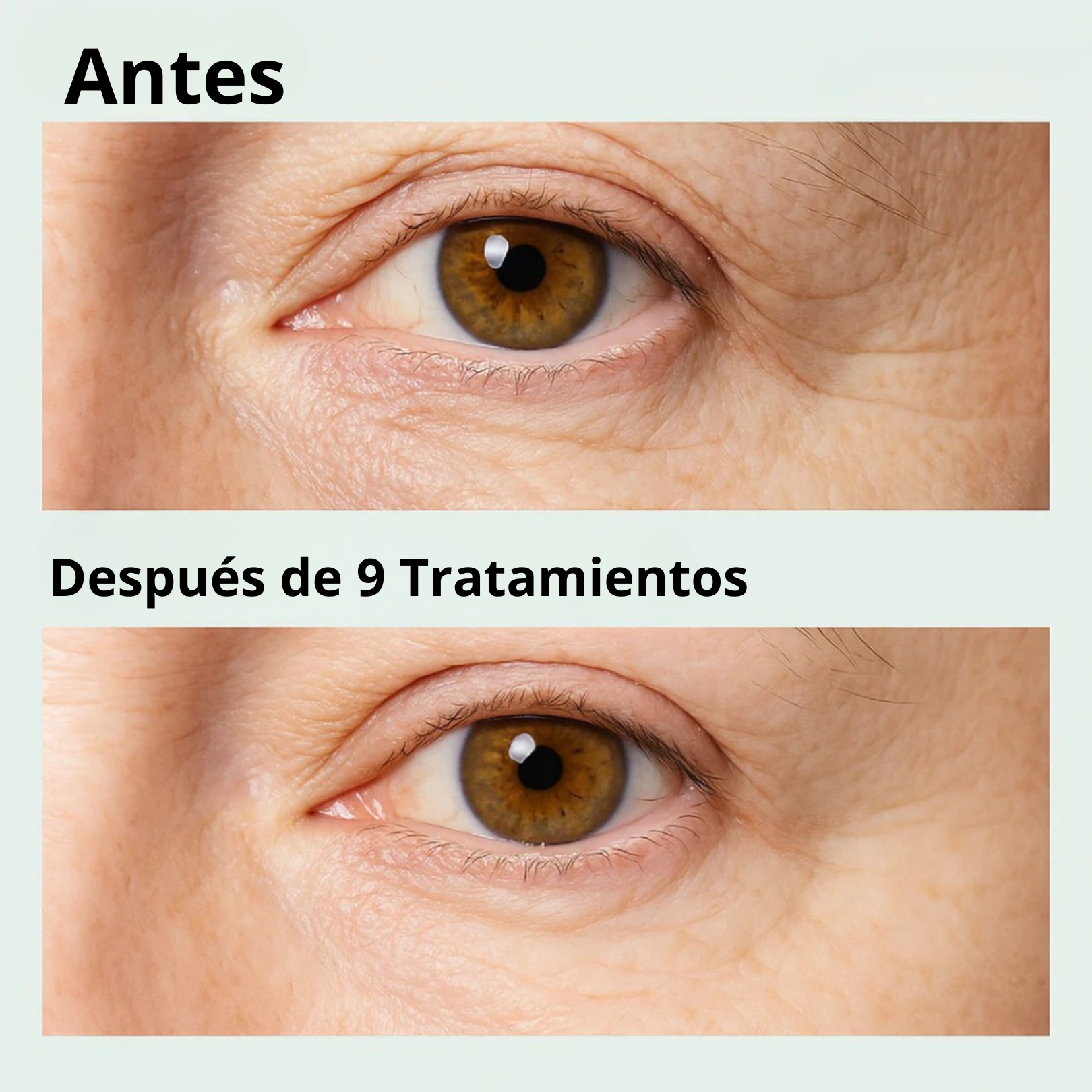 Parche Avanzado de Micro-Infusión