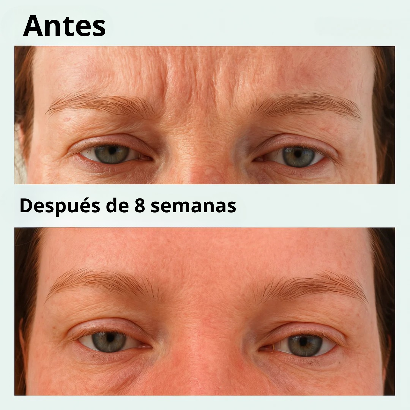 Parche Avanzado de Micro-Infusión