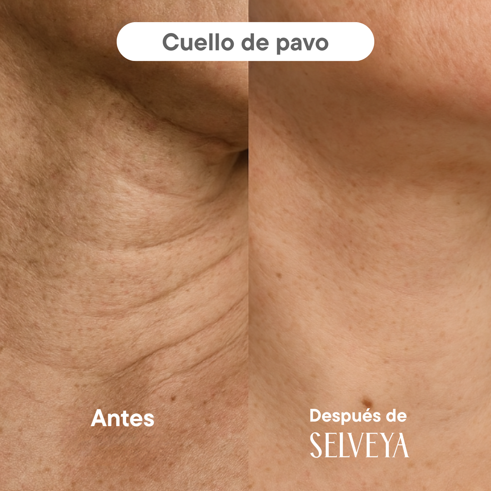 Crema de Colágeno Post-Tratamiento